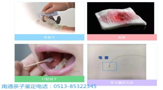 亲子鉴定解开家庭所有心结与猜忌/南通亲子鉴定